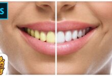 أسهل طريقه لتبيض و تنظيف الأسنان بإحترافيه علي فوتوشوب | BEST Way to Whiten Teeth in Photoshop CC